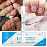  Onychomycosis Paronychia Anti Fungal Nail Infection Liquid Fungal Nail Treatment Pen Chinese Herbal Care Medicinal 